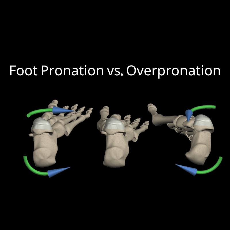 Body Proportion Effect on Deadlift