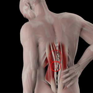 Blog featured image back pain