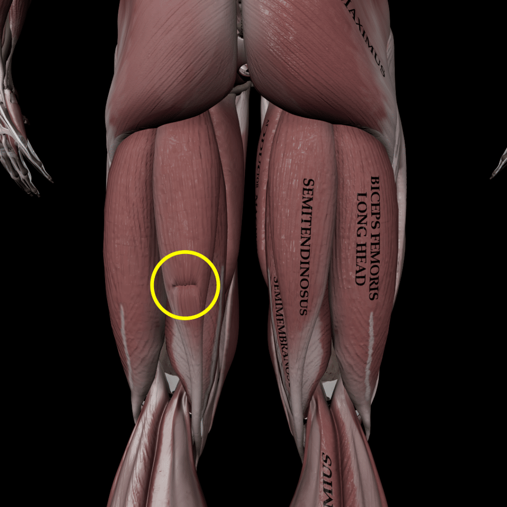 Hamstring Strain